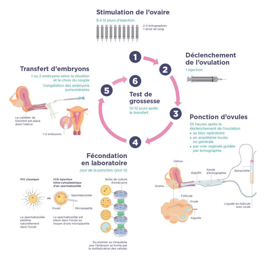 Déroulement d'une fécondation in vitro