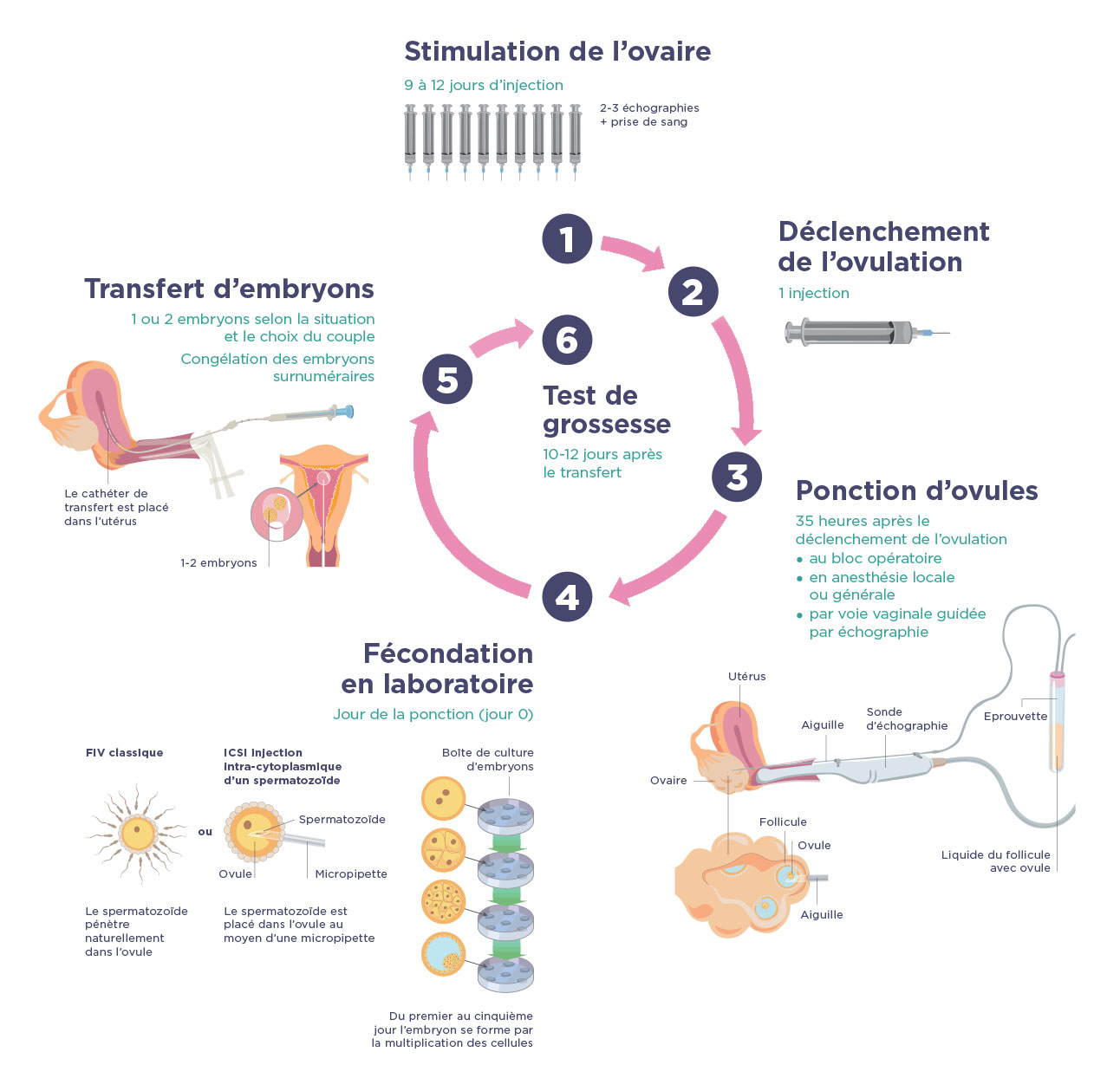 Déroulement d'une fécondation in vitro