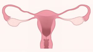 Ovarian puncture: a key stage in the in vitro fertilisation process